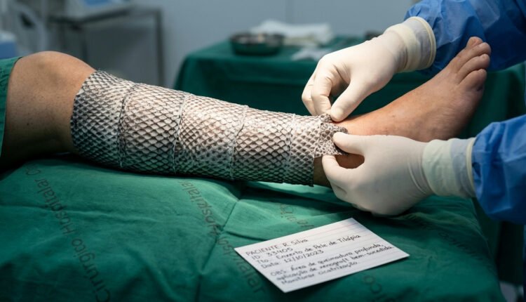 Ceará inova com fábrica mundial de pele de tilápia para tratamento de queimaduras